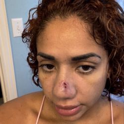 Rod Rohrich, MD - BEFORE