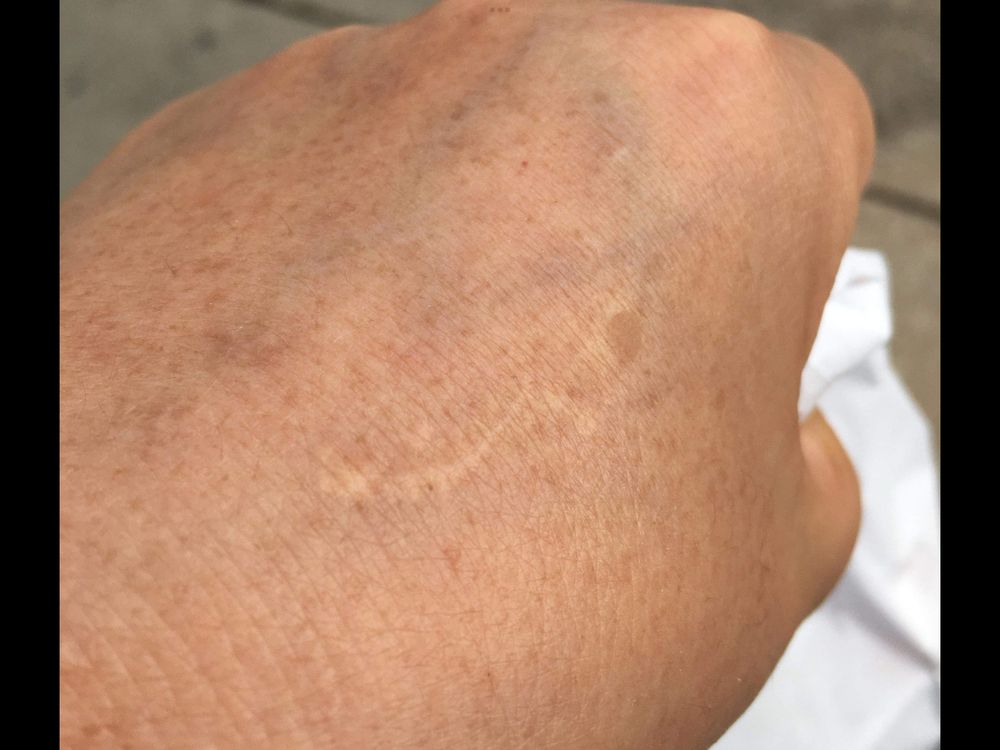 Sarah’s Medical Ink & Scar Camouflage Logo