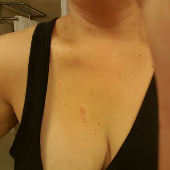 Rodeway Inn - Bed. Bugs. - Hotels Near Me - Cheyenne, Wyoming
