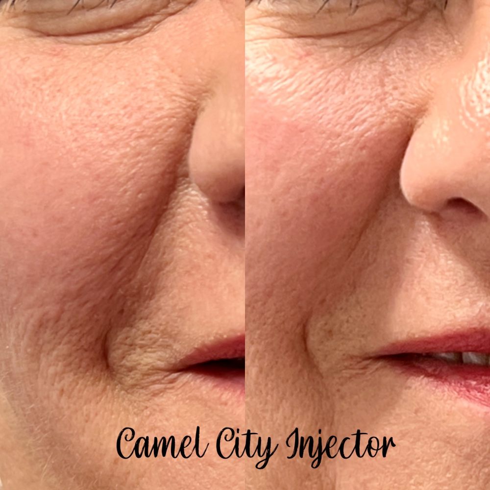 CAMEL CITY INJECTOR Request an Appointment 34 Photos 533 S Main