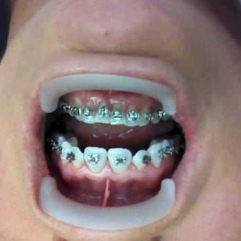 Mayer Rudolf DDS - Oral Surgeons Near Me - Whittier, California Mayer Rudolf DDS - Oral Surgeons Near Me - Whittier, California