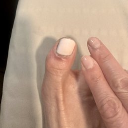 Infected skin on big toe caused by the rough handling at the salon. still not healed after a week :(