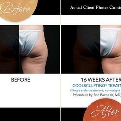 Southern Tier Dermatology - Southern Tier Dermatology