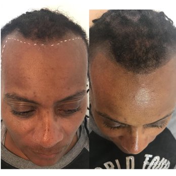 Ink Hair Studio - untitled - Hair Loss Centers Near Me - Trotwood, Ohio Ink Hair Studio - untitled - Hair Loss Centers Near Me - Trotwood, Ohio