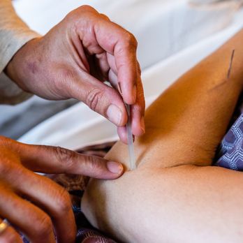 Alma Acupuncture - Acupuncture Near Me - Oakland, California