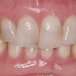 SmileCare Dental