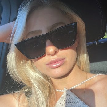 VS Med Spas - Russian lip lift - lip filler by Victoria Sophia - Medical Spas Near Me - Beverly Hills, California