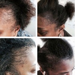 Hairline Time