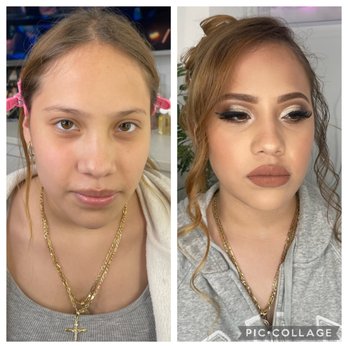 Bare Beauty KD - Teeth Whitening Near Me Bare Beauty KD - Teeth Whitening Near Me