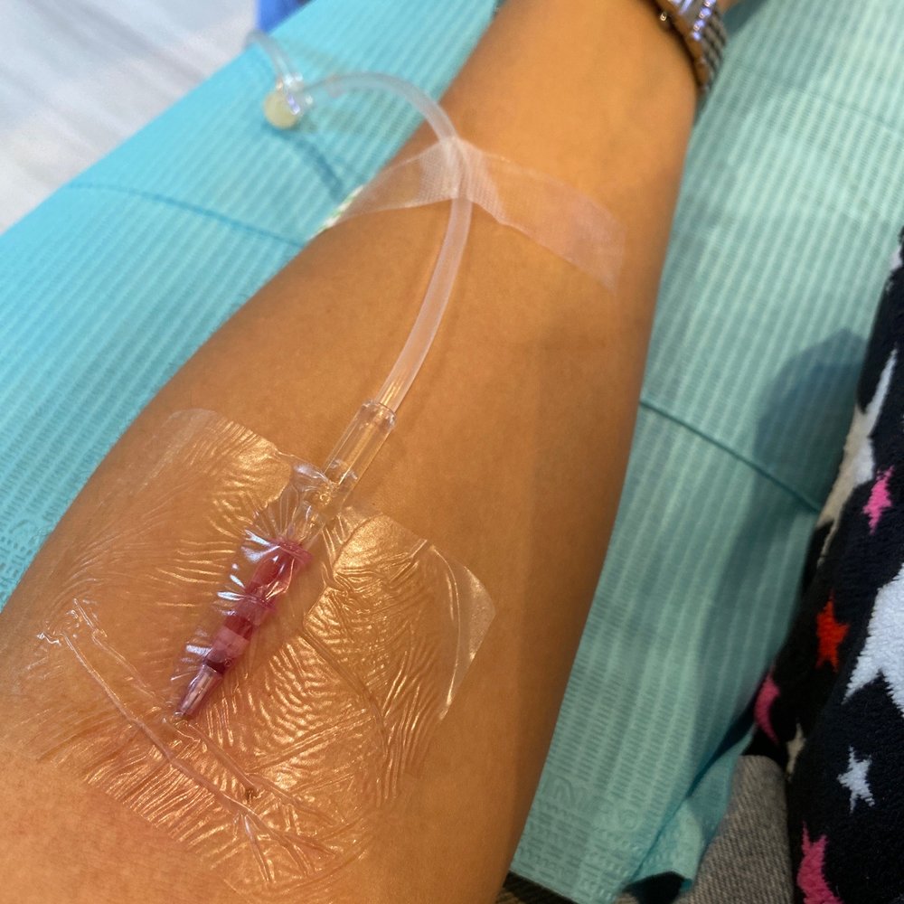 Flush IV Hydration - IV Hydration Near Me - Newport Beach, California Flush IV Hydration - IV Hydration Near Me - Newport Beach, California