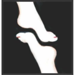 Advanced Foot Clinic