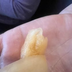 New China Buffet - This picture shows the fruit after the waitress chewed it and spit it back into her hand.