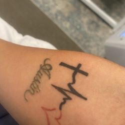 Bonsai Laser Tattoo Removal