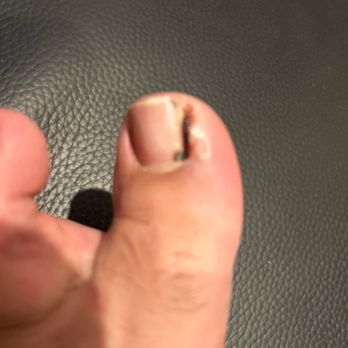 Mermaid Nails - Injured toe - Nail Salons Near Me - Marina, California
