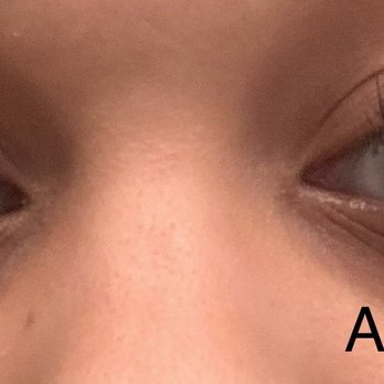 Cherry Lash - After a week of getting a full set , my lashes were originally soooo thick - Eyelash Service Near Me - Henderson, Nevada Cherry Lash - After a week of getting a full set , my lashes were originally soooo thick - Eyelash Service Near Me - Henderson, Nevada