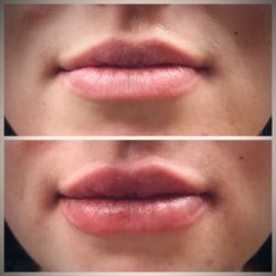 Pomperaug Plastic Surgery