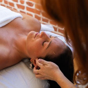 Treehouse Acupuncture - Acupuncture Near Me - Encinitas, California