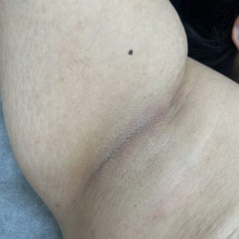 ALittle Wax Studio - After - Underarm wax - Waxing Near Me - Whittier, California