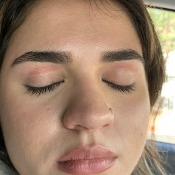 Bellas Nails and Spa - above her eyes you can see the burn marks - Nail Salons Near Me - Rancho Cucamonga, California Bellas Nails and Spa - above her eyes you can see the burn marks - Nail Salons Near Me - Rancho Cucamonga, California