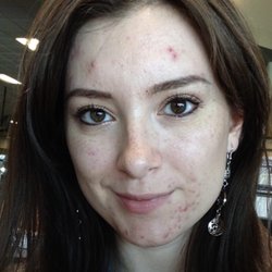 Southwest Cosmetic Dermatology Associates - Before