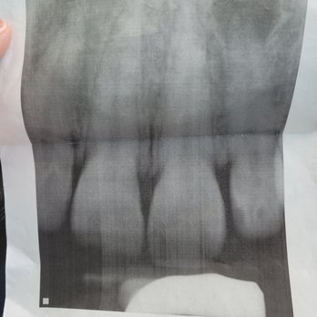 City Dental Care - General Dentistry Near Me - Hesperia, California City Dental Care - General Dentistry Near Me - Hesperia, California
