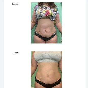 Vanity Beauty Boutique - Teeth Whitening Near Me - Las Vegas, Nevada Vanity Beauty Boutique - Teeth Whitening Near Me - Las Vegas, Nevada