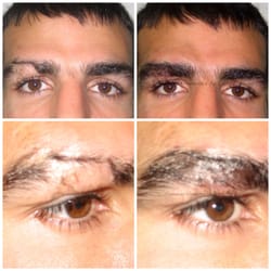 Enhancing Beauty - Male client with a scar covered with a Hair Stroke permanent cosmetic procedure.