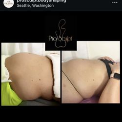 Studio ProSculpt