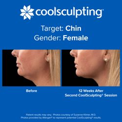 Dr. Sculpt CoolSculpting & EmSculpt Center
