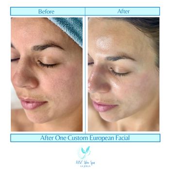 Rise Skin Spa - Skin Care Near Me - San Diego, California Rise Skin Spa - Skin Care Near Me - San Diego, California