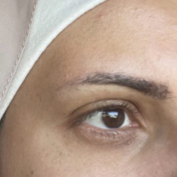 New Image Med Spa - Before Microblading - Medical Spas Near Me - Rancho Cucamonga, California New Image Med Spa - Before Microblading - Medical Spas Near Me - Rancho Cucamonga, California