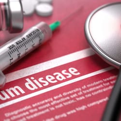 Ruslan Korobeinik, DDS - Bad breath, red, bleeding gums are signs of gum disease - let us help you!!! call today!