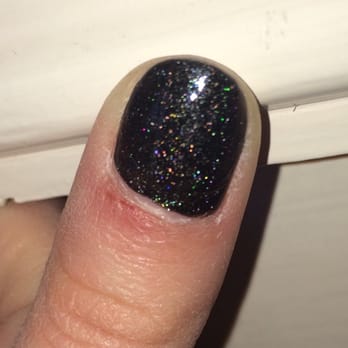 Sunset Nails - Small but painful slash on thumb from acrylic nail removal process. I have 2 others on other fingers. - Nail Salons Near Me - San Francisco, California