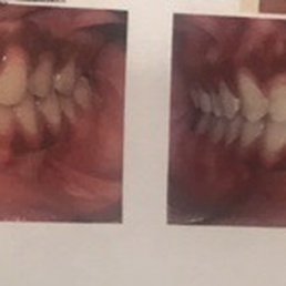 My before and after My before and after