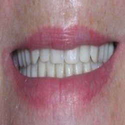 Comfortable Dentistry 4U