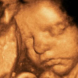 Expecting Miracles