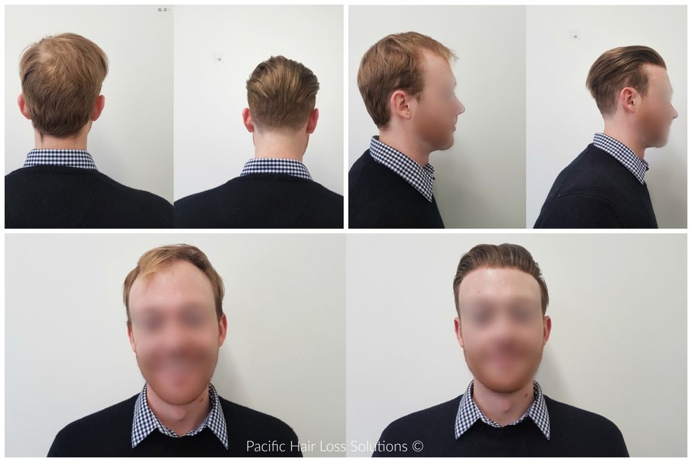 Pacific Hair Extensions Hair Loss Solutions 20 Photos Hair