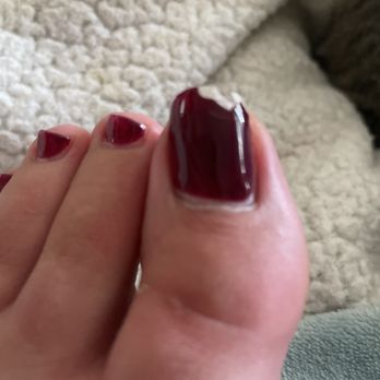Luxury Spa & Nails - They drilled my toe nail so thin that it literally just broke off a week after. - Hair Removal Near Me - Albuquerque, New Mexico