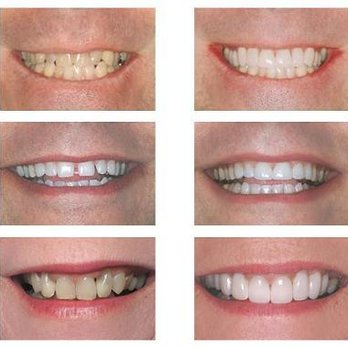 Thor Mikesell - Dentist - General Dentistry Near Me - Suttons Bay, Michigan