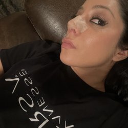 Dr. Herrera Rivera Mariano - Still feeling positive! 1 week post rhino. Swelling has subsided alot but i know i still have a long way to go from my final result/shape.