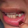 Kawaii Tooth Gems