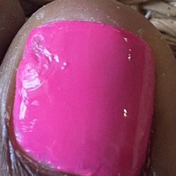 Saigon Nails - My mangled big toe - by the time I got home from the nail place. And with the nail dividers intact! - Hair Removal Near Me - Fredericksburg, Virginia