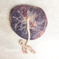 Placenta Encapsulation