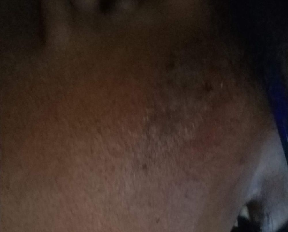 WOODSIDE APARTMENTS Updated June 2024 11 Photos 1631 Fernwood