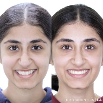 Orthodontics LA - Orthodontists Near Me - Glendale, California Orthodontics LA - Orthodontists Near Me - Glendale, California