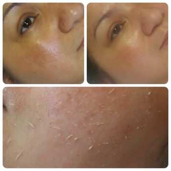 Kanebo Skincare - Exfoliant facial - Skin Care Near Me - San Jose, California Kanebo Skincare - Exfoliant facial - Skin Care Near Me - San Jose, California