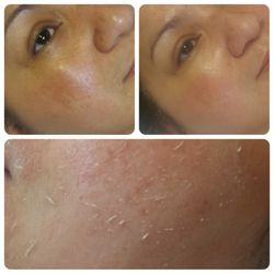 Kanebo Skincare - Exfoliant facial