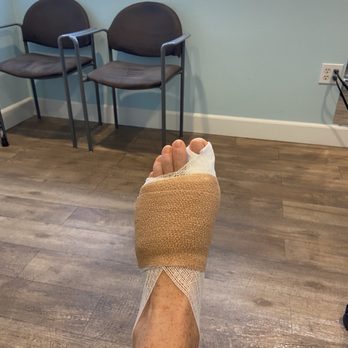 Alvera Podiatry Group - Second post op after bunion surgery. - Podiatrists Near Me - Encinitas, California Alvera Podiatry Group - Second post op after bunion surgery. - Podiatrists Near Me - Encinitas, California