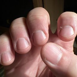 Here's my manicure I had done just 7 hours ago. Horrible pedicure, as well! Here's my manicure I had done just 7 hours ago. Horrible pedicure, as well!