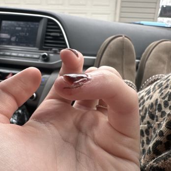Inails - the cut the lady gave me while doing my nails - Nail Salons Near Me - Lino Lakes, Minnesota